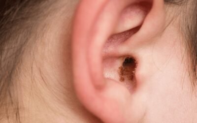 Earwax Removal Leicester: 7 Signs You Need It